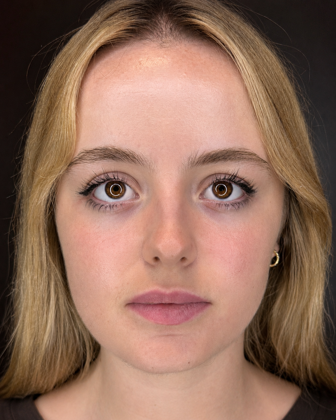 image comparison before
