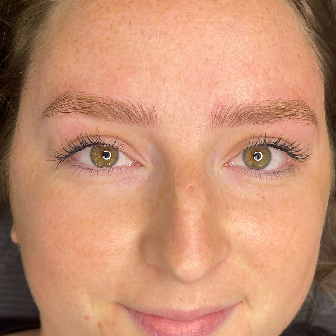 image comparison after