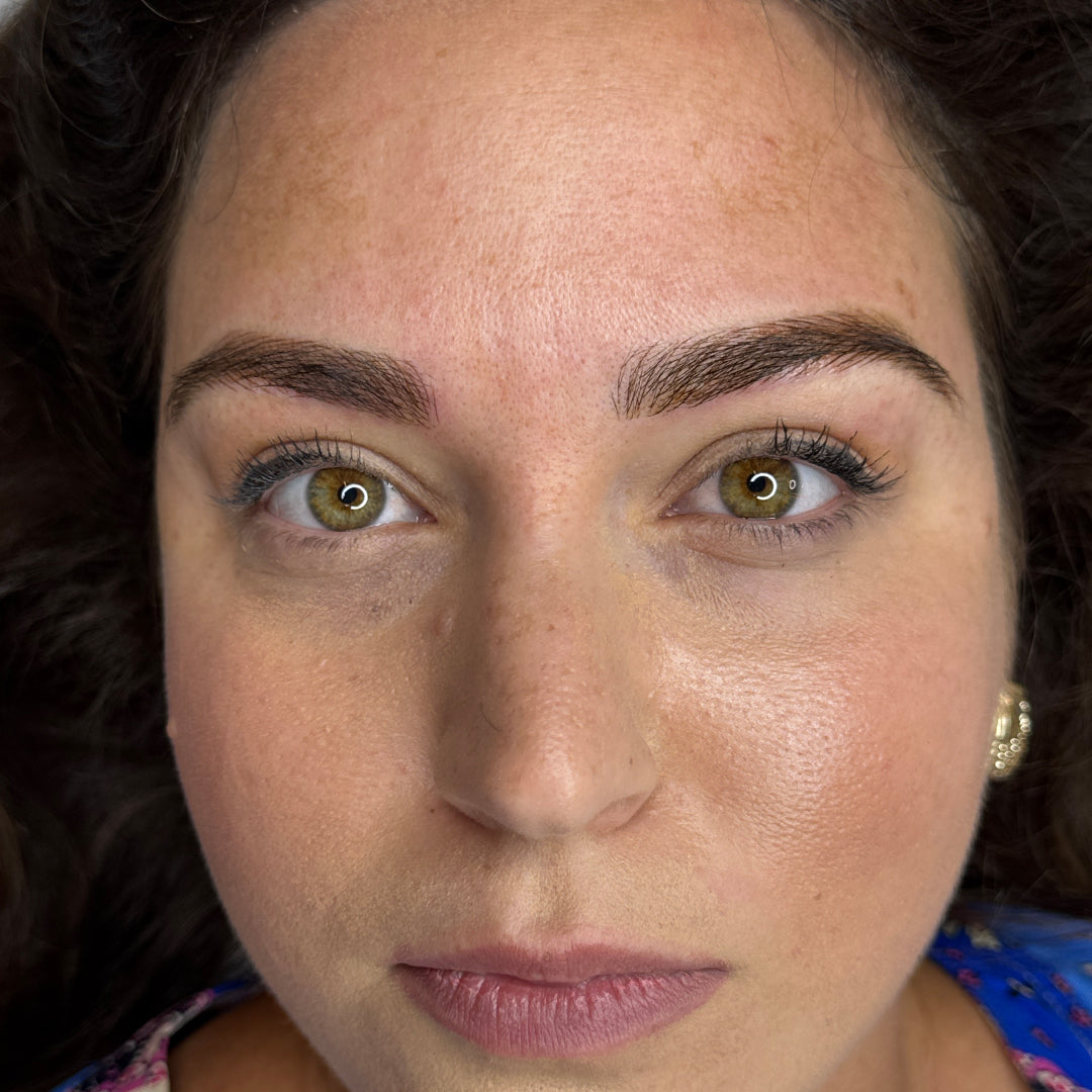 image comparison after
