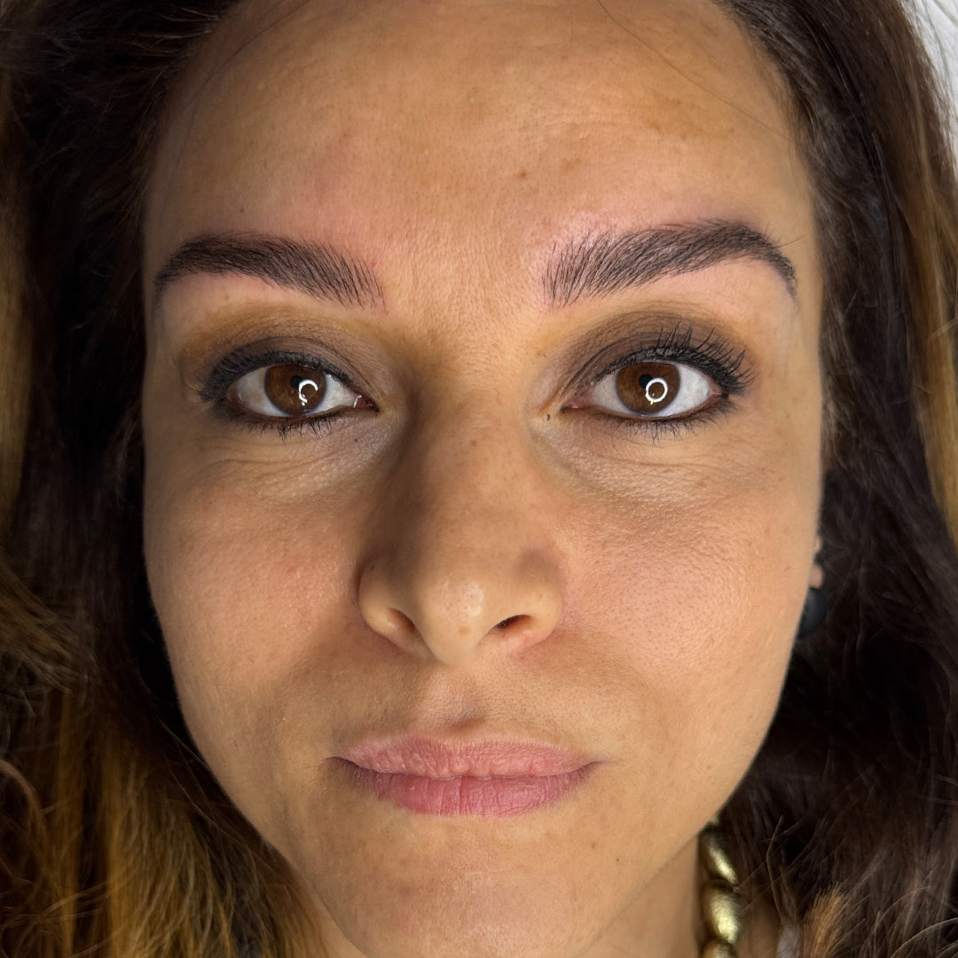 image comparison after