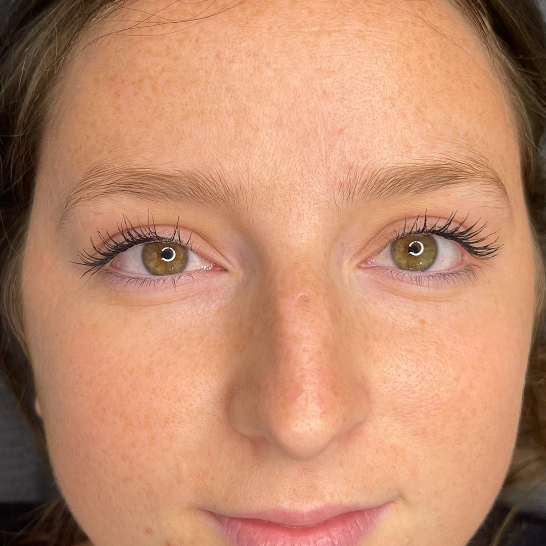 image comparison before