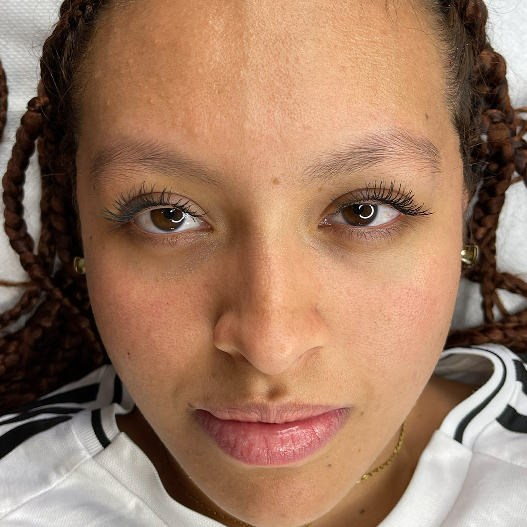 image comparison before